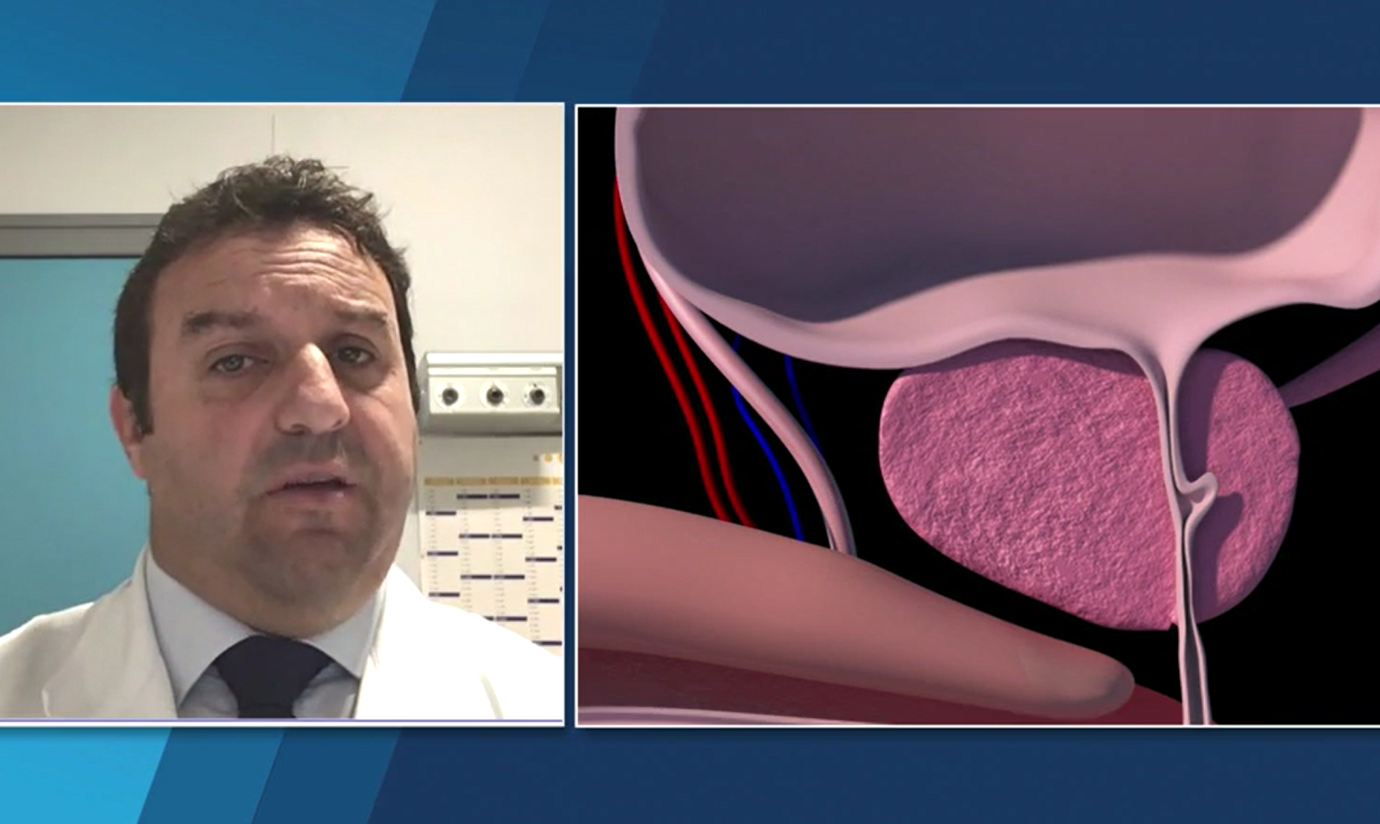 Il medico risponde, l'urologo Ambruosi: